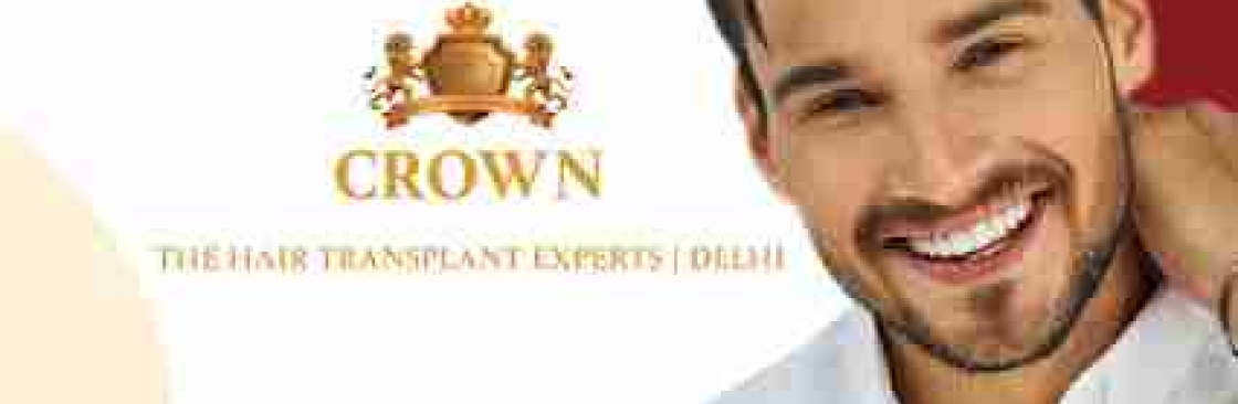 Crown hair Cover Image