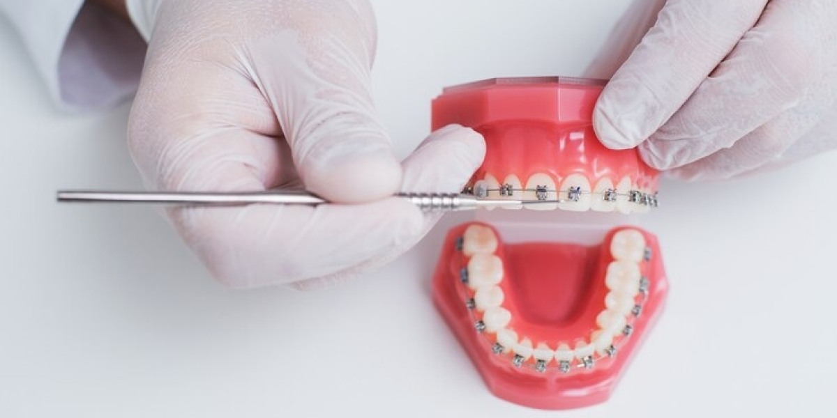 Finding the Right Orthodontist in Corbin, KY