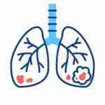 Lung Cancer Treatment Profile Picture