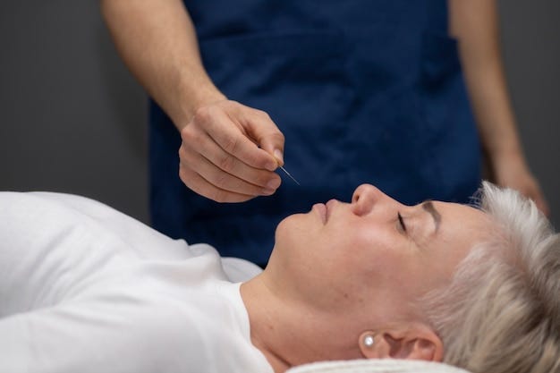 Holistic Healing: Acupuncture for Mental Health in Frederick, MD | by Ellicott Acupuncture Centre | Mar, 2025 | Medium