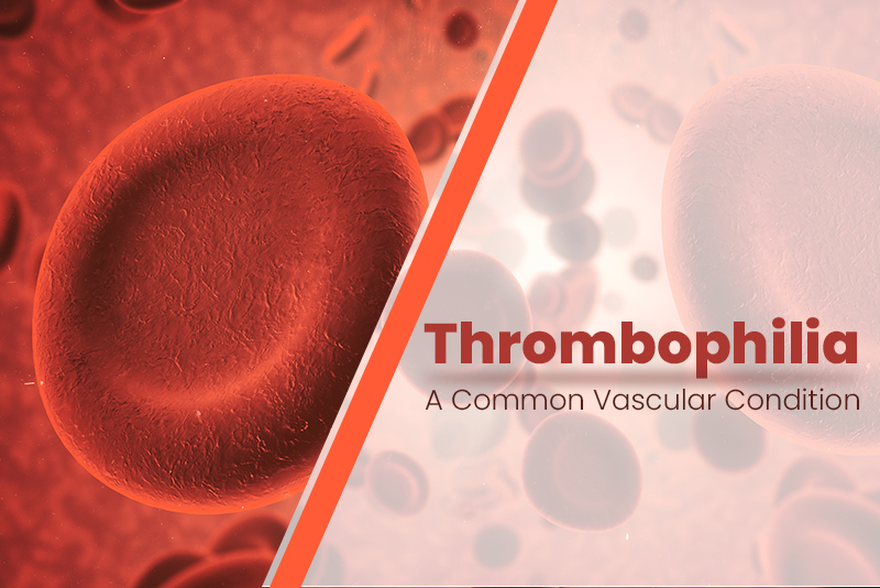 How to Code Thrombophilia Accurately and Effectively