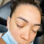 Eyebrow Tattoo Removal Tri Cities Profile Picture