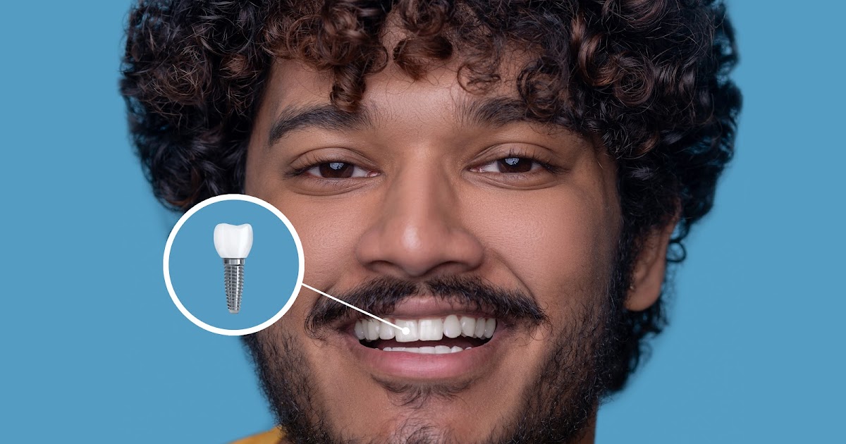 Restore Your Smile with Implants & Cosmetic Crowns