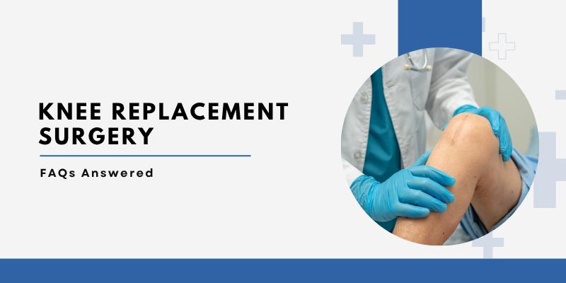 Knee Replacement Surgery: Most Common FAQs Answered