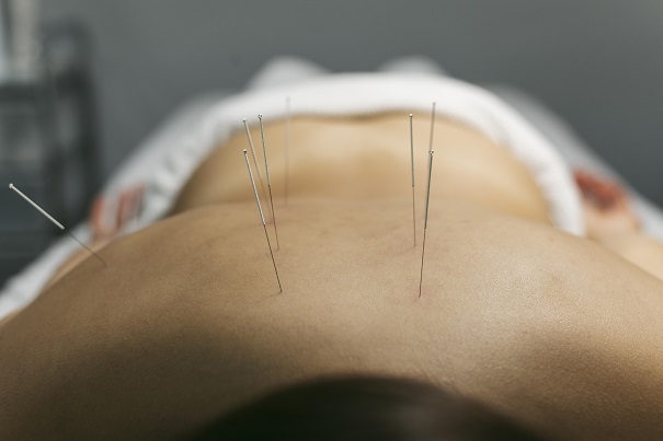 Restoring Balance: Chinese Acupuncturist In Frederick | Author Ellicott Acupuncture Centre