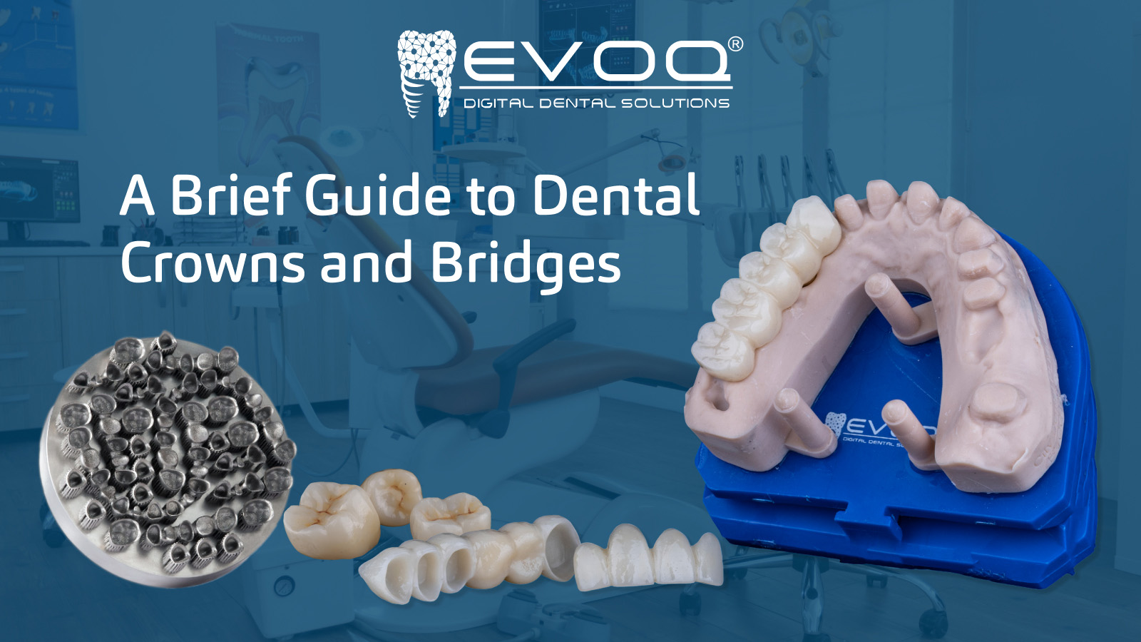 Restore Your Smile: Dental Crowns & Bridges Guide