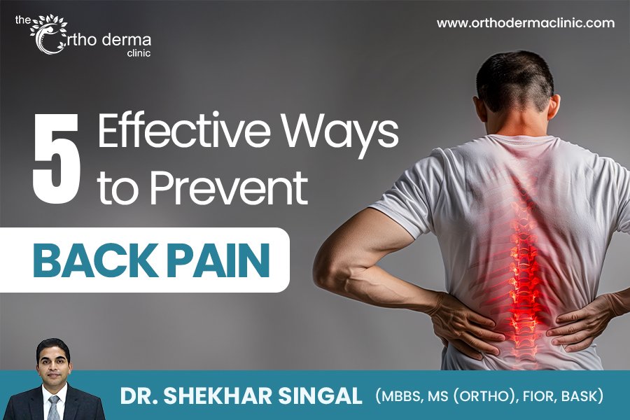 5 Best Ways to Prevent Back Pain Naturally » Orthodermaclinic