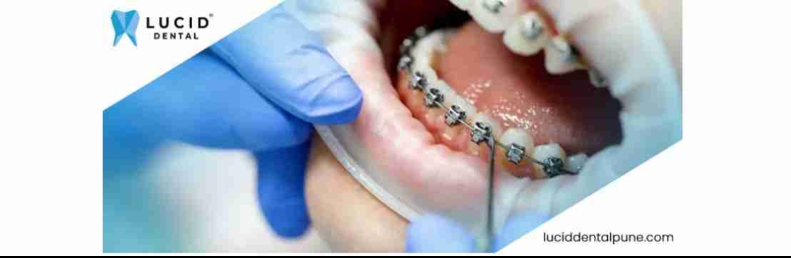 Lucid Dental Cover Image