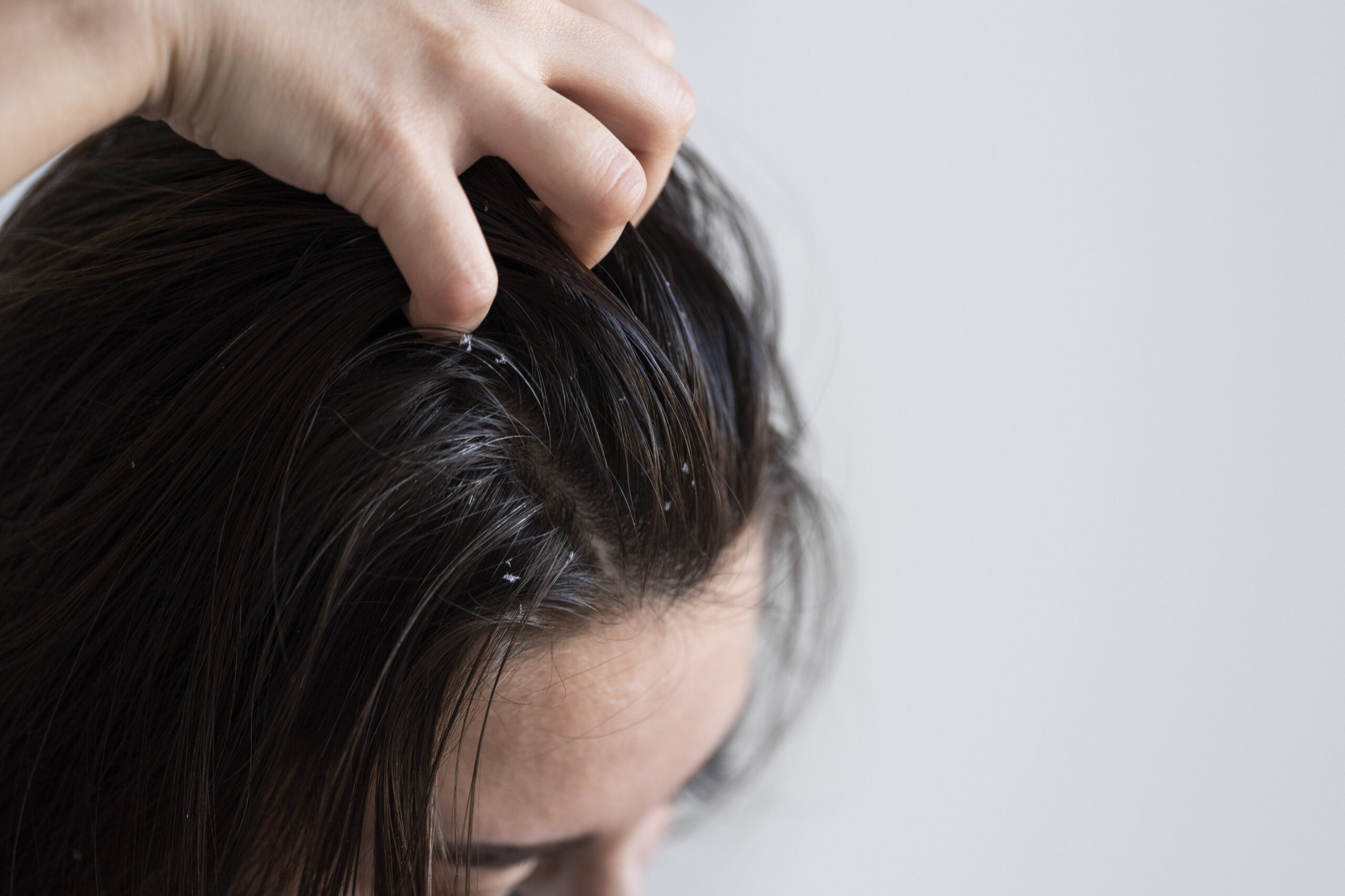 Summer Heat and Sweat Impact on Scalp Health
