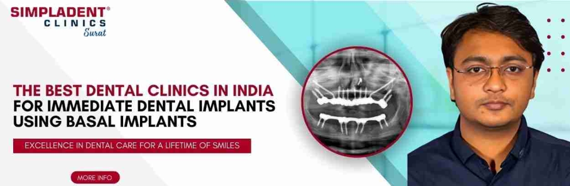 Best Dental Implants Surgeon in Surat Cover Image