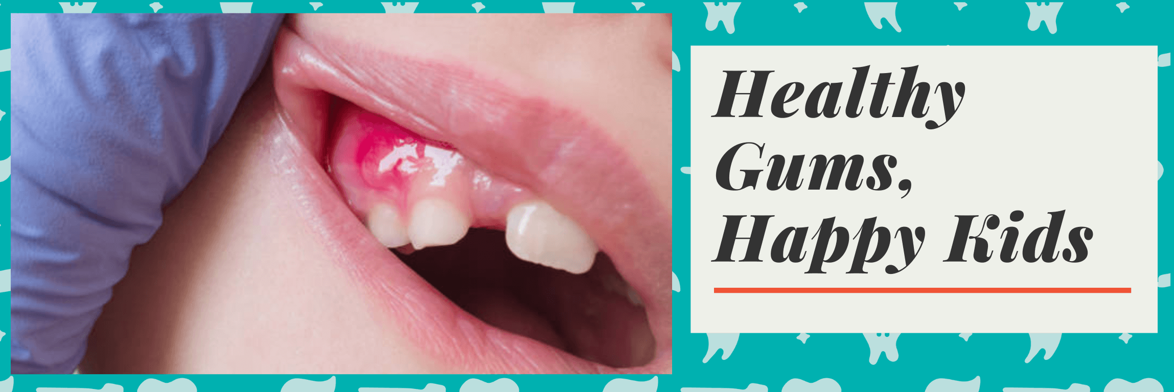 Gum Disease in Kids: What Parents Need to Know | PDG Dental | Pediatric Dentistry & Orthodontics