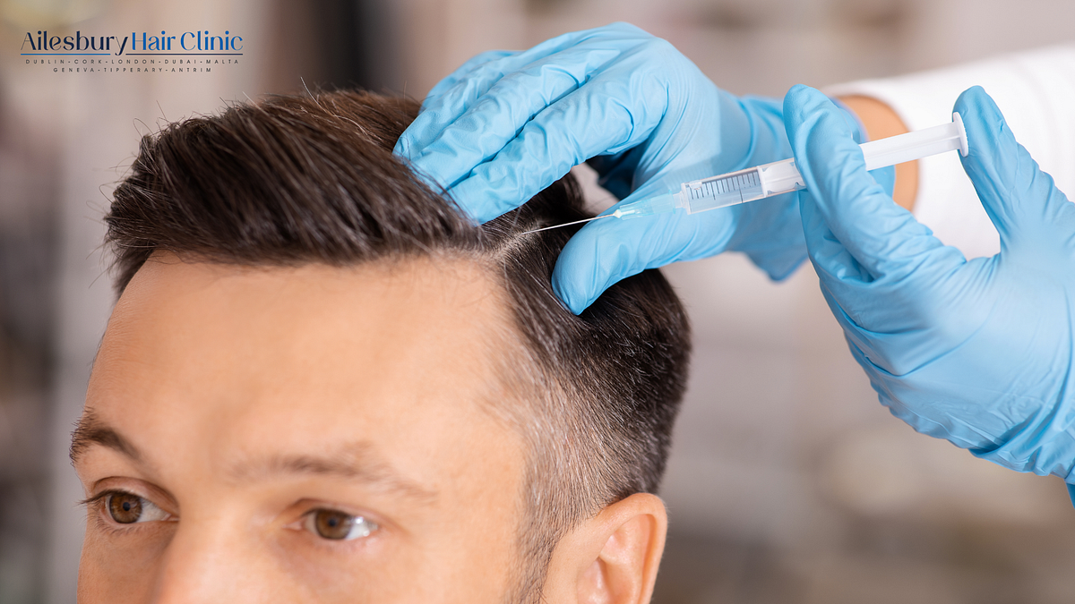 Best Hair Loss Treatment in Ireland | Ailesbury Hair Clinic | by Ailesbury Hair Fleming Place Clinic | Aug, 2025 | Medium