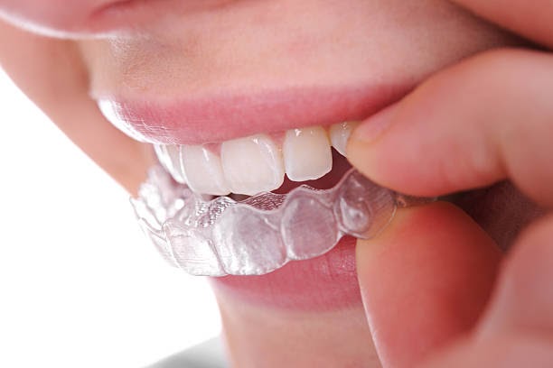 Invisible Braces, Visible Results: Invisalign in Five Forks SC