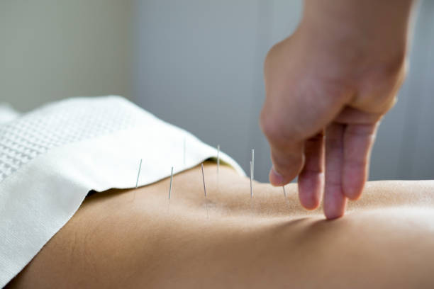 8 Ways an Acupuncture Clinic Supports Women’s Health – Writoka