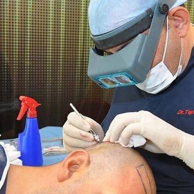 Hair Transplant Cost in Islamabad, Pakistan 2025