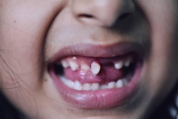 Expert Guide to Dental Repairs & Smile Enhancements
