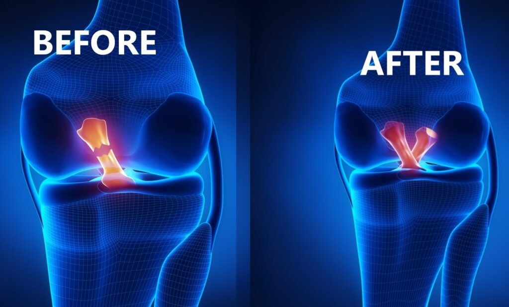 Advanced Care for Arthroscopy Knee Surgery in Delhi | Dr. Khera’s Wellness Clinic – Blog Land
