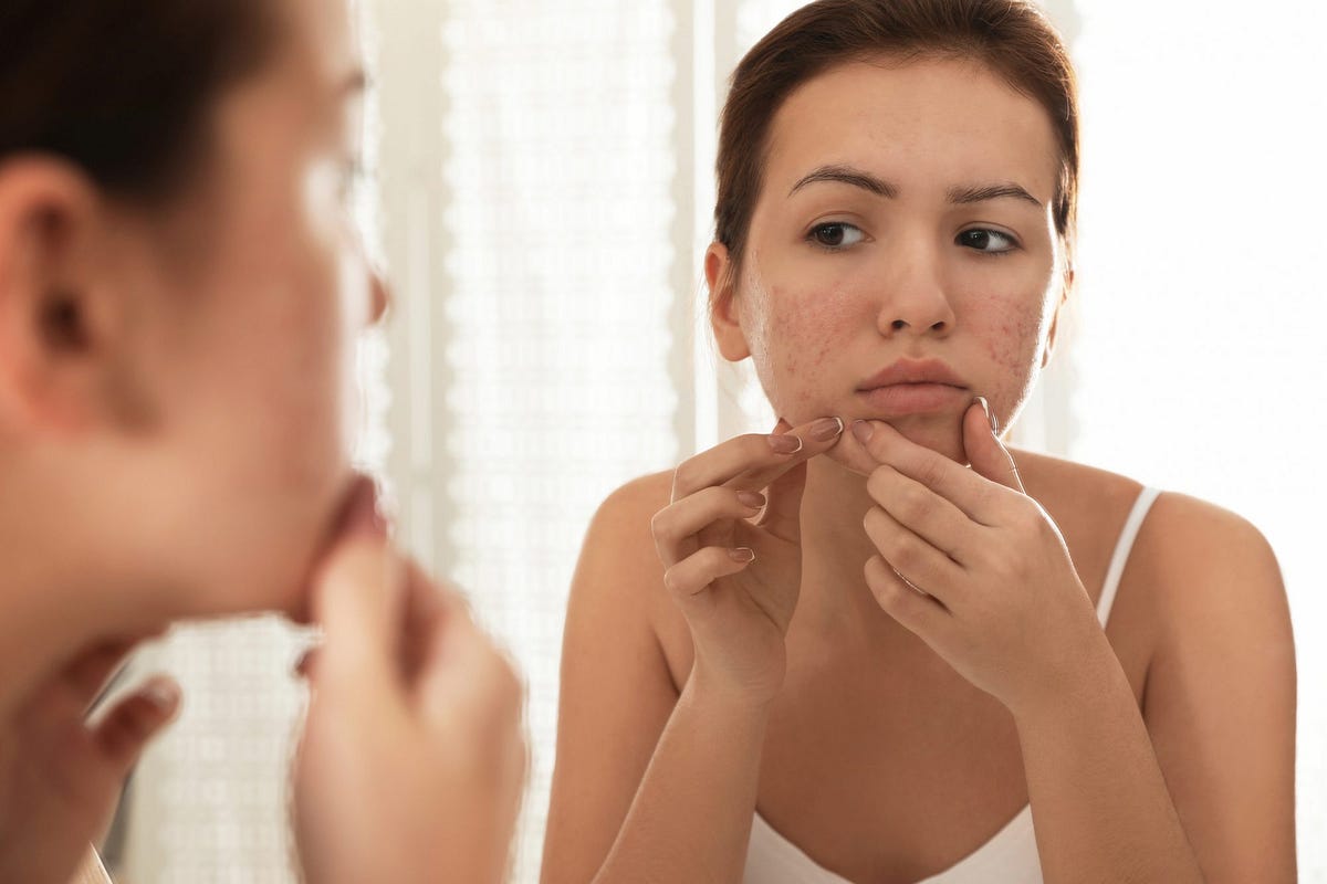How Seasonal Changes in Toronto Affect Rosacea and What to Do? | by Tight Clinic Toronto | Oct, 2025 | Medium