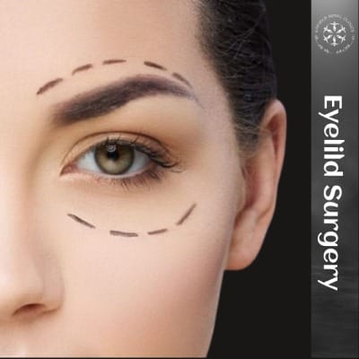 Eyelid Surgery in Islamabad- Blepharoplasty - ERCs