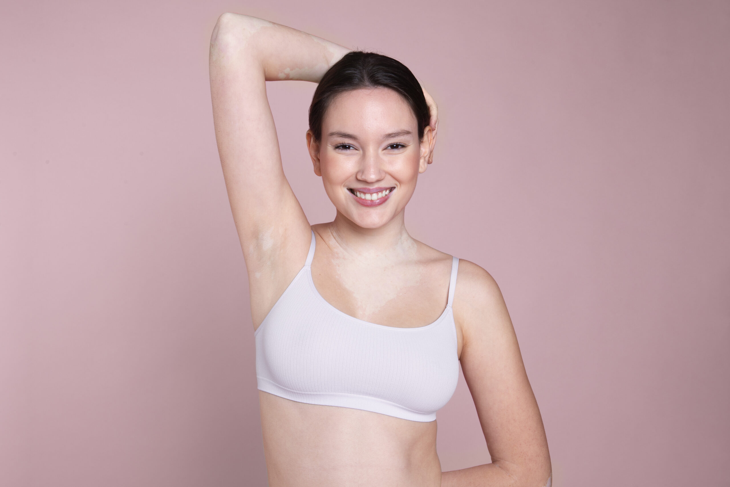 Underarm Laser Hair Removal in Calgary | Pacific Laser Clinics