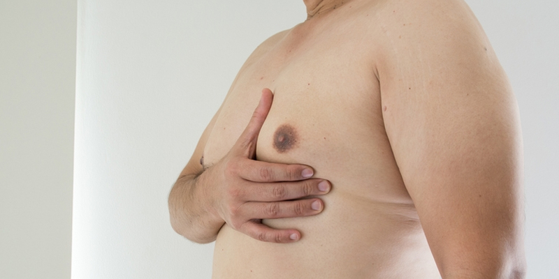 Reduce Gynecomastia Naturally Without Surgery