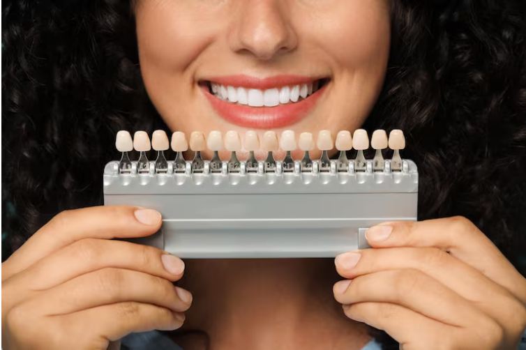 Smile Makeover? Try 3D Veneers – Here’s Why