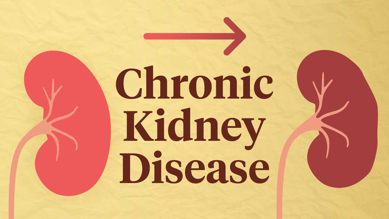 Chronic Renal Failure Treatment in Delhi | Dr. Amit Kumar