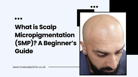 What is Scalp Micropigmentation (SMP) A Beginner’s Guide