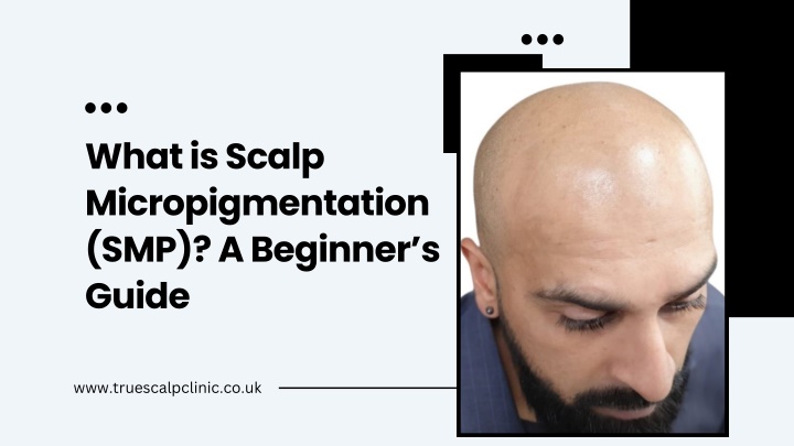 PPT - What is Scalp Micropigmentation (SMP) A Beginner’s Guide PowerPoint Presentation - ID:14705363