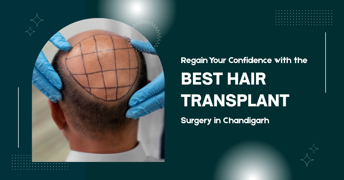 Best Hair Transplant Surgery in Chandigarh | Mahendra Hair & Skin