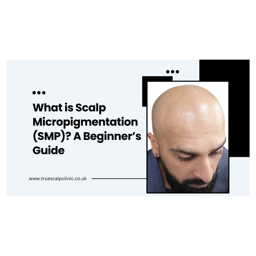 What is Scalp Micropigmentation (SMP)? A Beginner’s Guide
