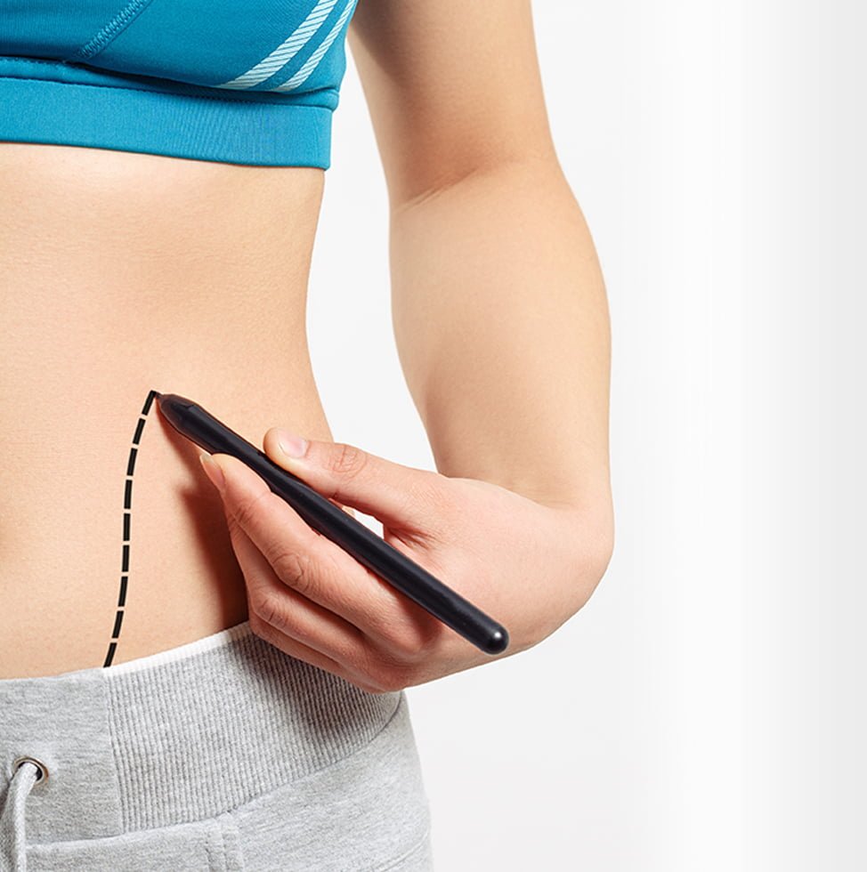 Best Liposuction Surgery in Delhi, Cost - Dr Monisha Kapoor