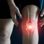 ArthrovixCream1 Profile Picture