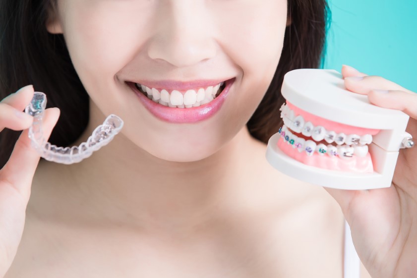 Invisalign vs. Braces Cost in Canada -