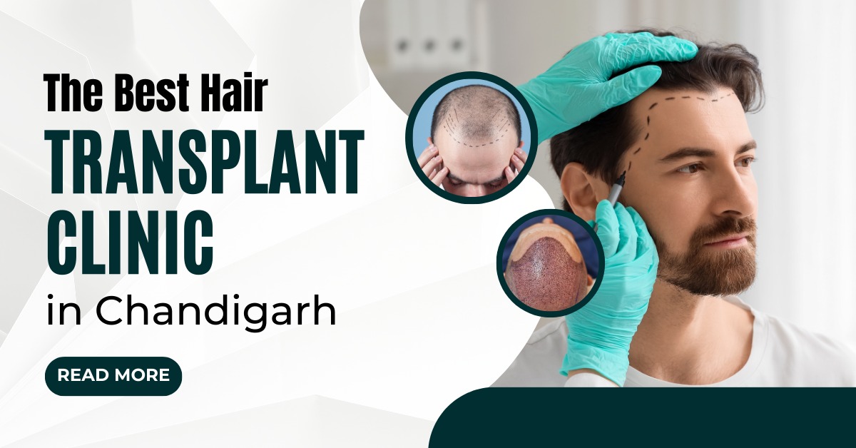 Best Hair Transplant Clinic In Chandigarh | Mahendra Hair And Skin