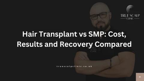 Hair Transplant vs SMP Cost, Results and Recovery Compared