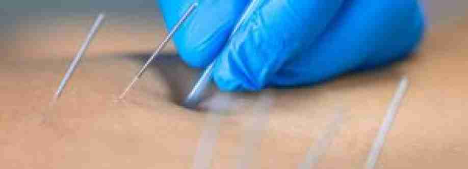 Nolan Hill Physiotherapy and Massage Cover Image