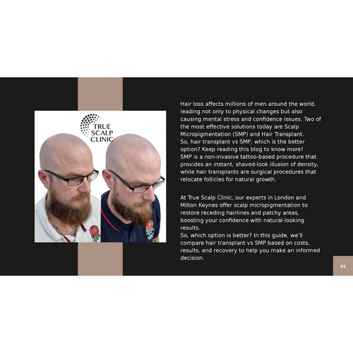 Hair Transplant vs SMP: Cost, Results and Recovery Compared