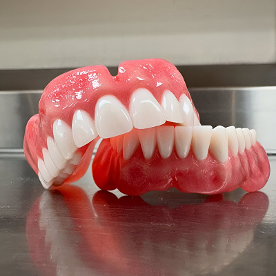 Best Dentures in Islamabad for Natural Smiles