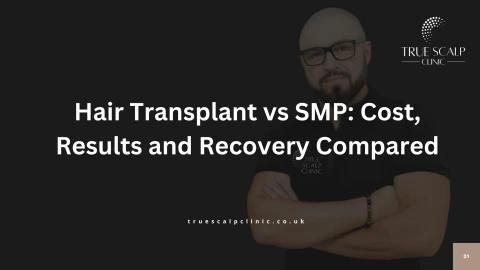 Hair Transplant vs SMP Cost, Results and Recovery Compared