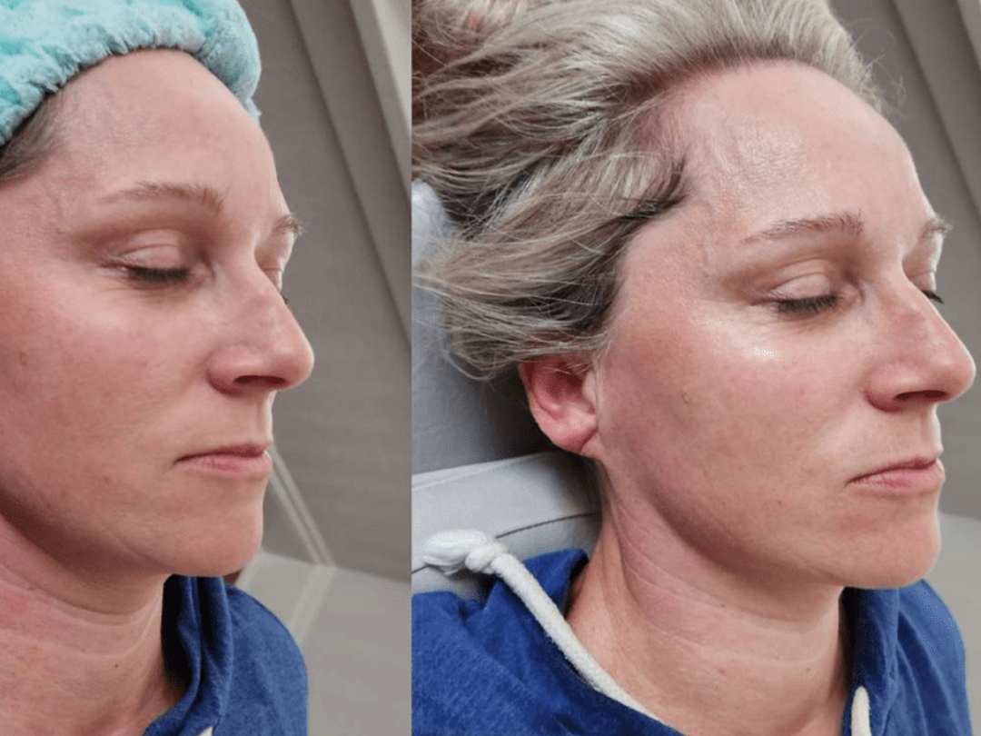 Top Cryotherapy Trends for 2026 | Personalized Recovery | Insight Cryo