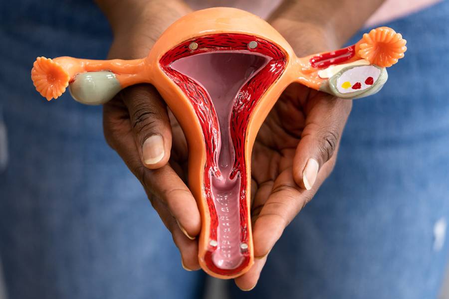 Ovarian Cancer Treatment - Dr. Chirag Bhirud
