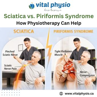 Sciatica vs. Piriformis Syndrome: How Physiotherapy Can Help