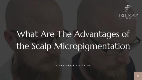 What Are The Advantages of the Scalp Micropigmentation