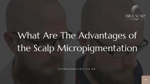 What Are The Advantages of the Scalp Micropigmentation