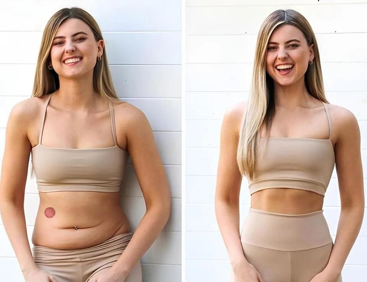 Berberine Patches Reviews - GLP-1 Patch for Metabolic Support & Weight Management!