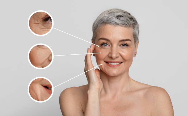 Preventative Aesthetics in Your 20s & 30s: Why Younger Patients Are Choosing Anti-Wrinkle Treatments Earlier - SkinHampshire - Wrinkle reduction treatment in Basingstoke
