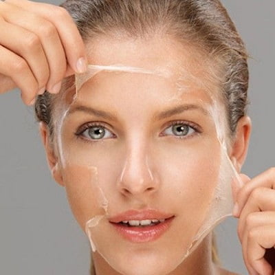 Chemical skin peel treatment in Islamabad Pakistan - RCS