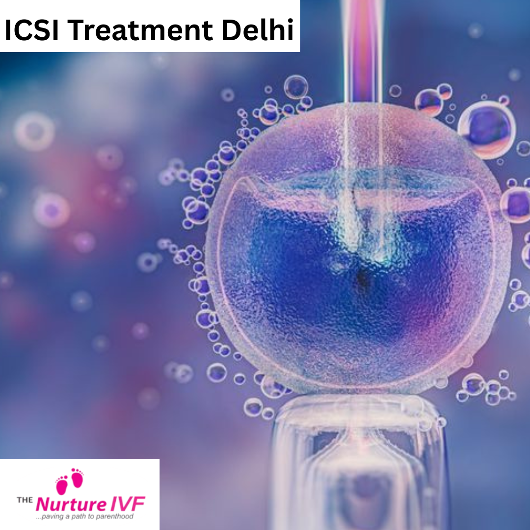 ICSI Treatment Delhi: Advanced Fertility Solutions with Dr. Archana...