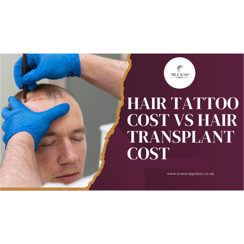 Hair Tattoo Cost vs Hair Transplant Cost: Which Option Offers Better Value